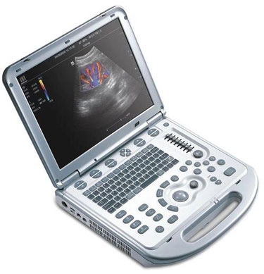 Chiropractic Rockville MD Muscuoloskeletal Ultrasound Monitor